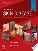 Treatment of Skin Disease E-Book