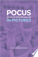 POCUS (Point-of-Care Ultrasound) in Pictures