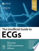 The Unofficial Guide to ECGs - E-Book