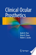 Clinical Ocular Prosthetics