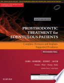 Prosthodontic Treatment for Edentulous Patients: Complete Dentures and Implant-Supported Prostheses - EBK