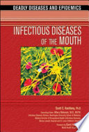 Infectious Diseases of the Mouth