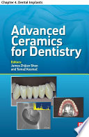 Advanced Ceramics for Dentistry