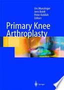 Primary Knee Arthroplasty