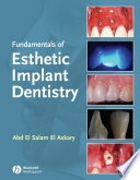 Fundamentals of Esthetic Implant Dentistry