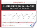Essential Concepts of Electrophysiology and Pacing through Case Studies