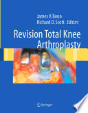 Revision Total Knee Arthroplasty
