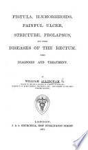 Fistula, haemorrhoids, painful ulcer, stricture, prolapsus, and other diseases of the rectum