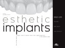 Esthetic implants