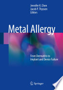Metal Allergy
