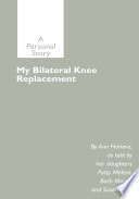 My Bilateral Knee Replacement
