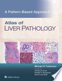 Atlas of Liver Pathology: A Pattern-Based Approach
