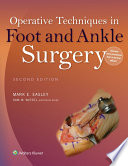 Operative Techniques in Foot and Ankle Surgery