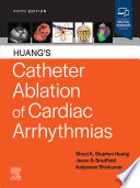 Catheter Ablation of Cardiac Arrhythmias E-Book