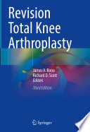 Revision Total Knee Arthroplasty