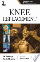 Knee Replacement