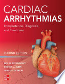 Cardiac Arrhythmias: Interpretation, Diagnosis and Treatment, Second Edition