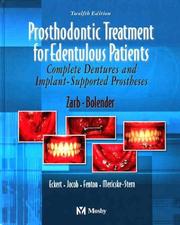 Prosthodontic treatment for edentulous patients