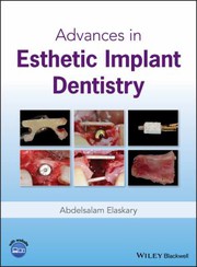 Fundamentals of Esthetic Implant Dentistry