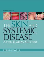 The skin and systemic disease