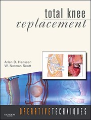 Total knee replacement