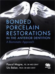 Bonded porcelain restorations in the anterior dentition