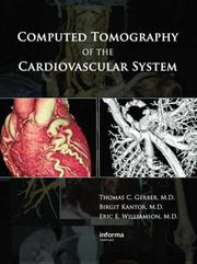 Computed tomography of the cardiovascular system