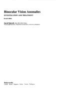 Binocular vision anomalies