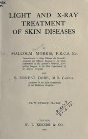 Light and x-ray treatment of skin diseases