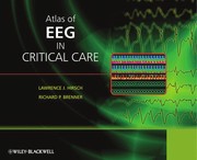 Atlas of EEG in critical care