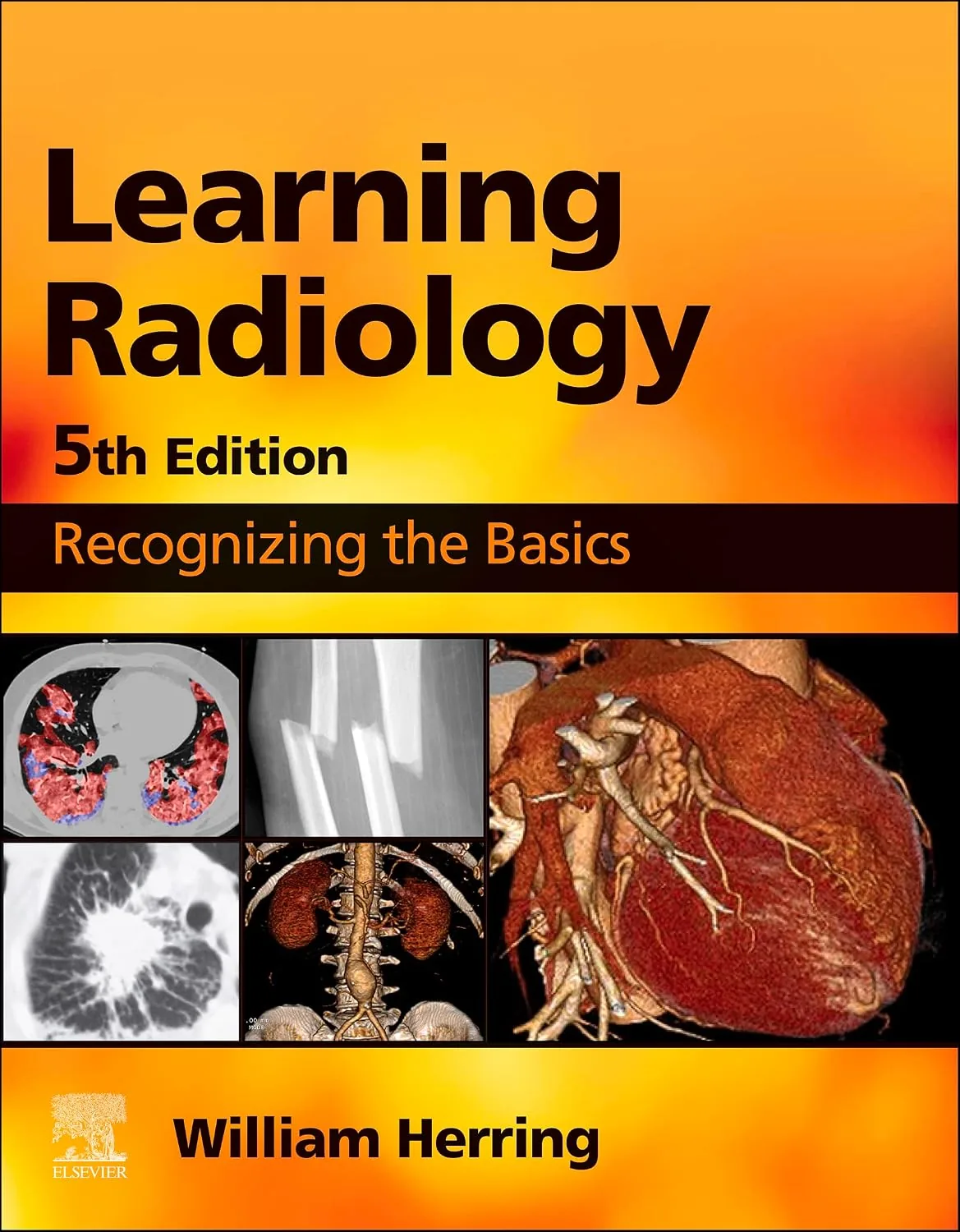 نسخه اصلی کتاب یادگیری رادیولوژی : شناخت اصول اولیه (Learning Radiology) هرینگ